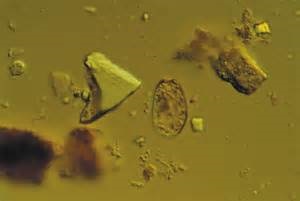Soil Protozoa and sand particle